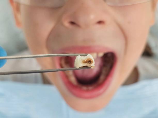 Best Emergency Care for Gum Disease in Los Banos, CA